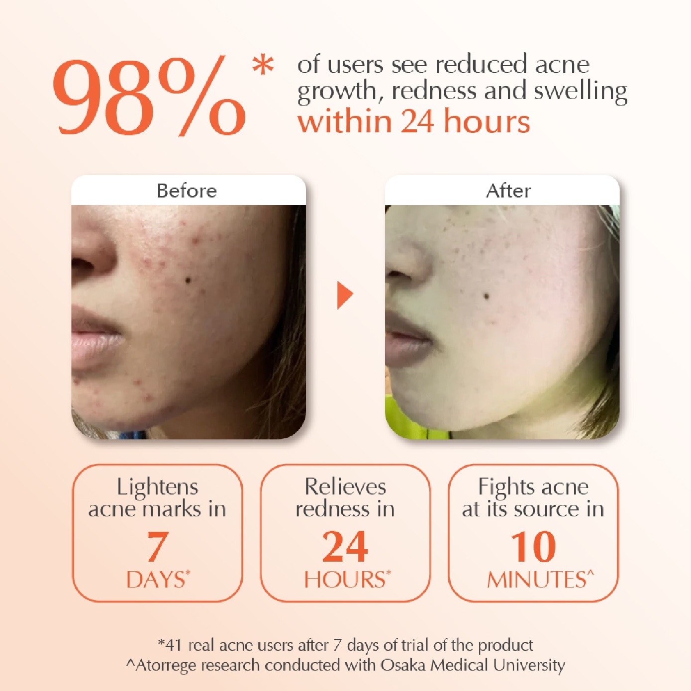 Acne Spots 10ml