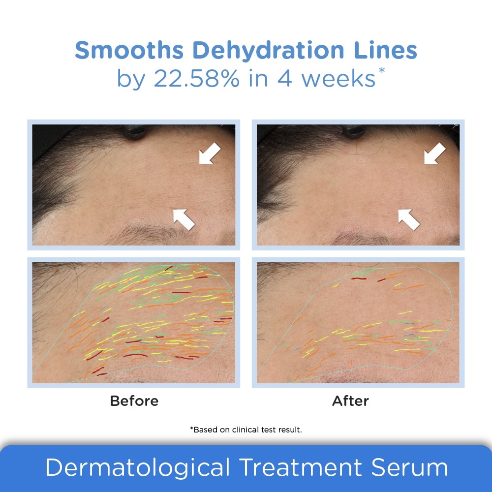 5KDA Hyaluronic Intensifier (Ultra-Low Molecular Weight Hyaluronic Acid) 30ml