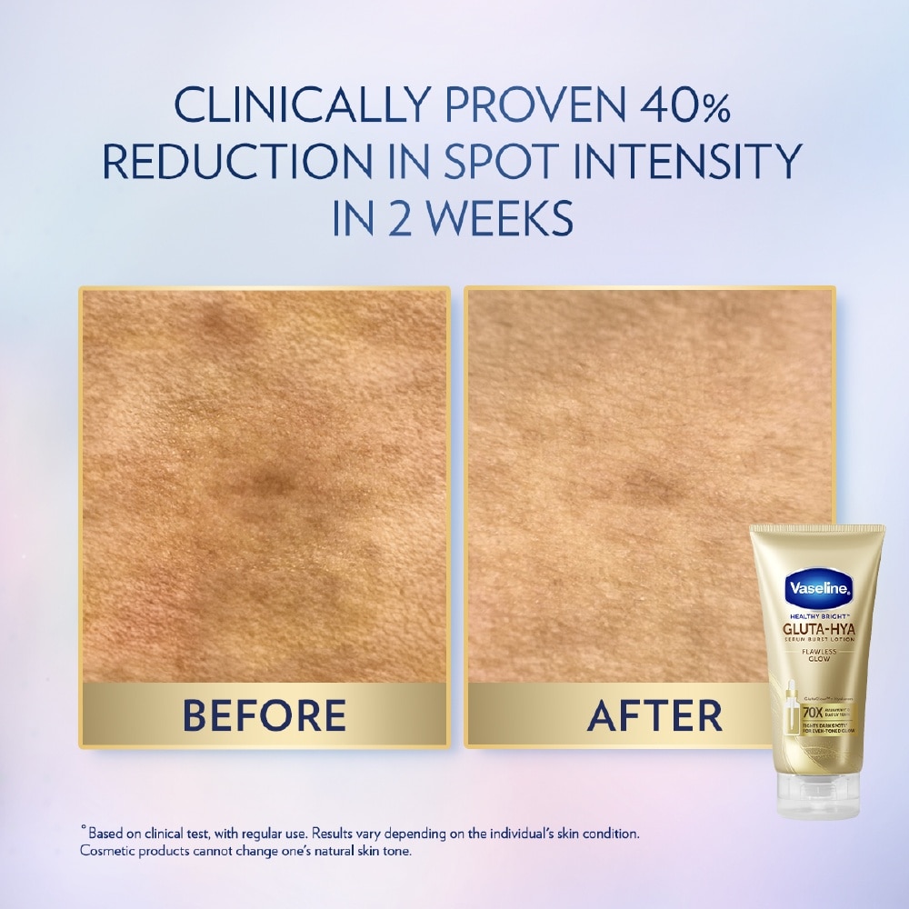 Healthy Bright Gluta-Hya Serum Burst Lotion Flawless Bright 300ml