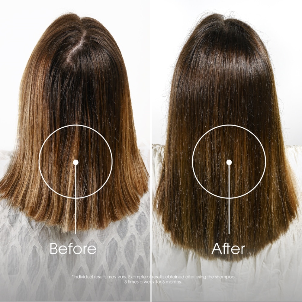 Quinine Strengthening + Anti-Hairloss Shampoo 400ml