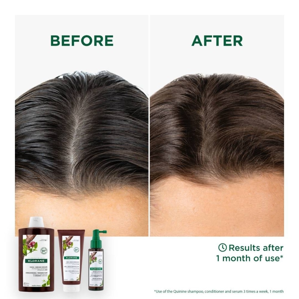 Strengthening - Thinning Hair Quinine & Organic Edelweiss Shampoo (Compatible With Pregnancy & Breast-Feeding) 400ml