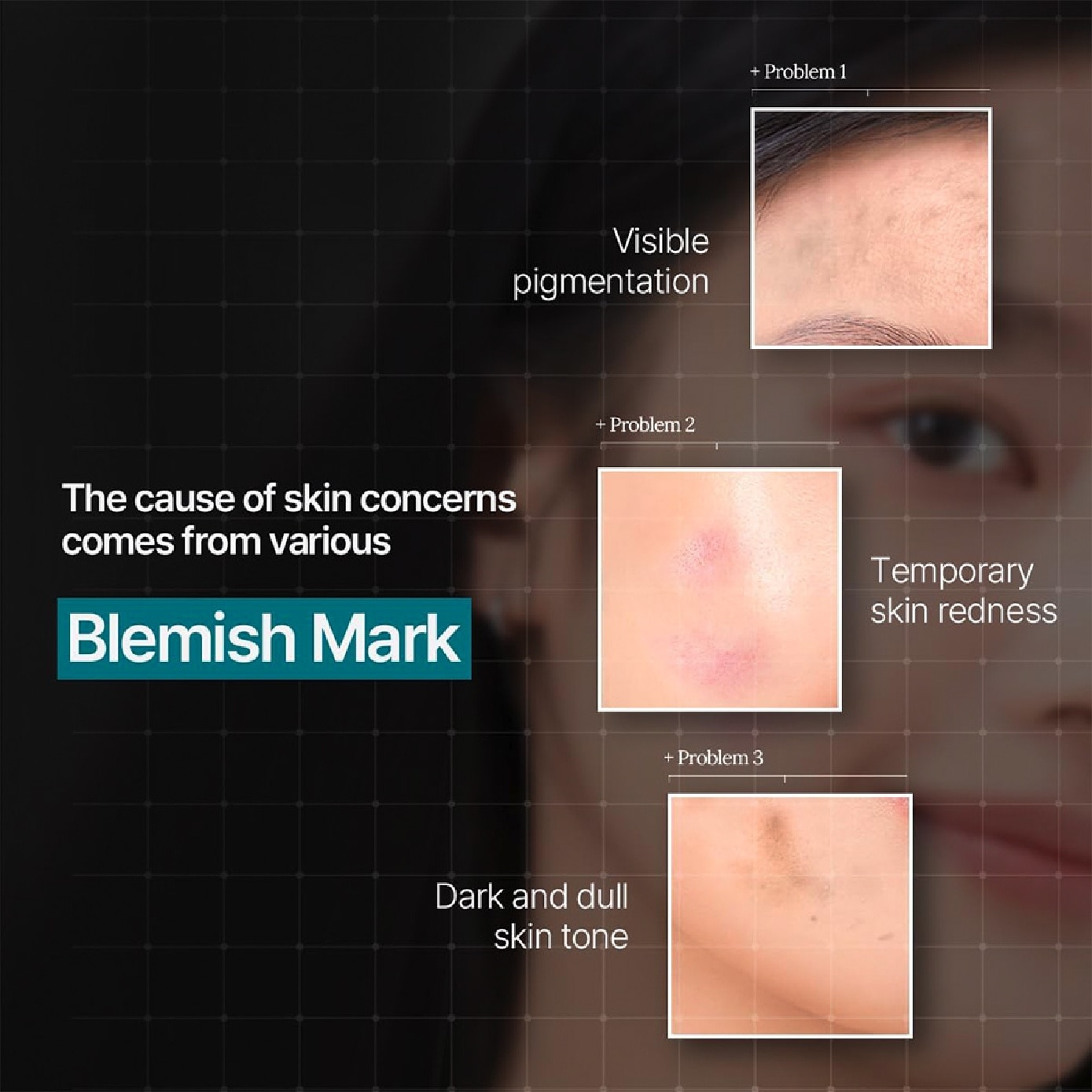 Madecassoside Blemish Repair Essential Face Mask 4s (Box)
