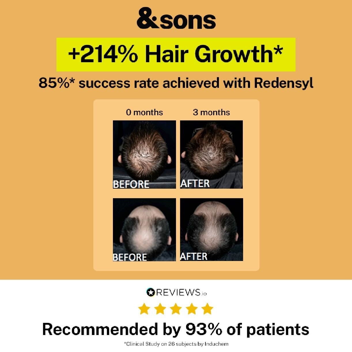 Hair Growth 3% Redensyl Hair Loss Treatment Serum (For Men's Hair Growth) 60ml)