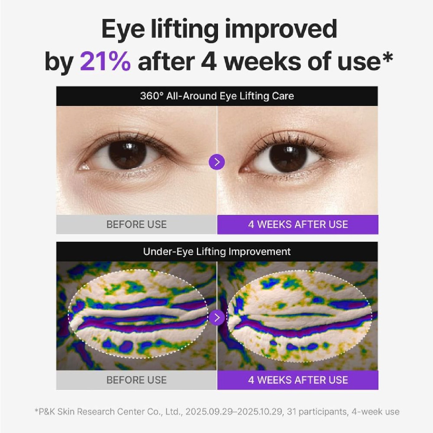 360° Shot PDRN Lifting Eye Cream 30ml
