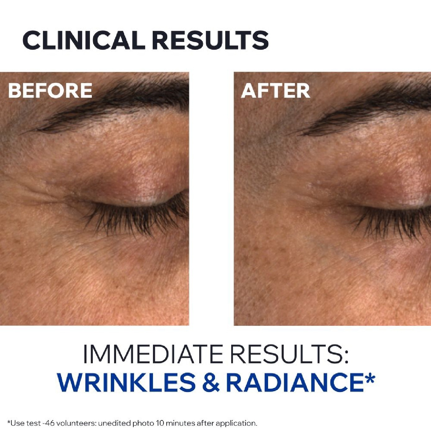 Age Absolu Blur-Redensifying Eye Balm 15ml