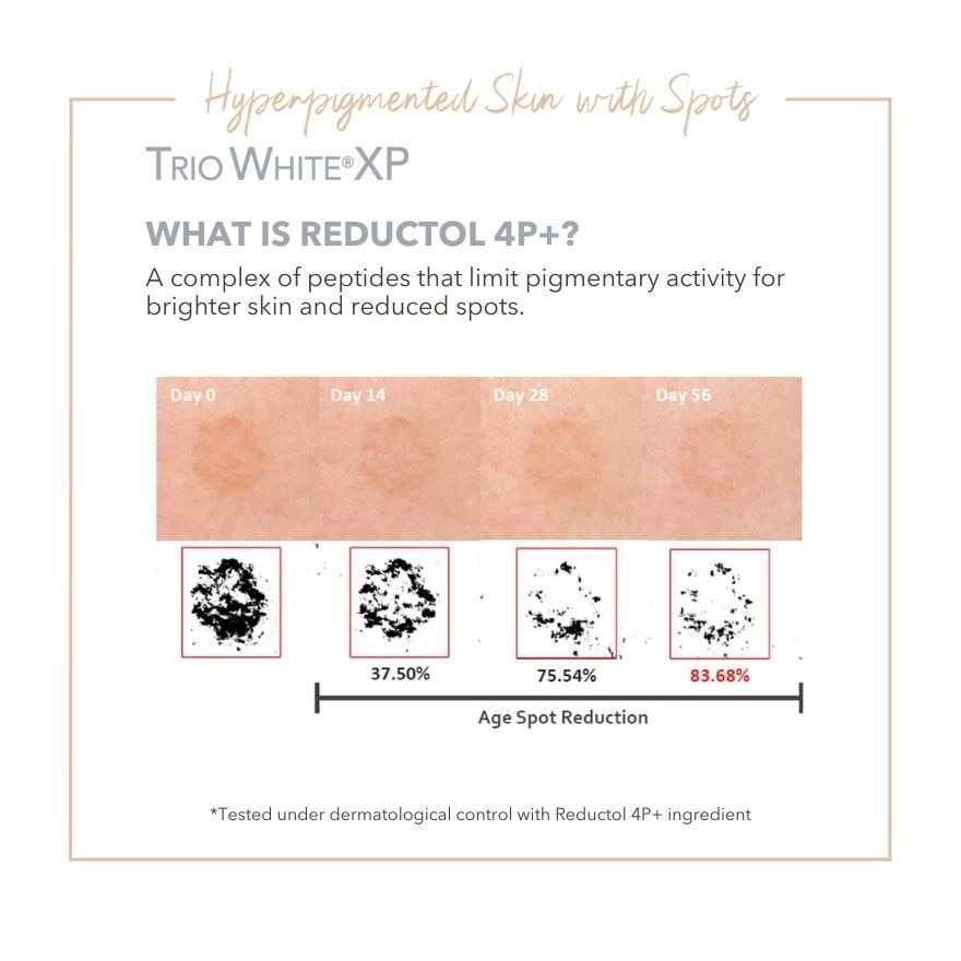 Trio White Xp Anti Dark Spot Serum (Treatment For Hyperpigmented Skin + Boost Skin Radiance) 30ml