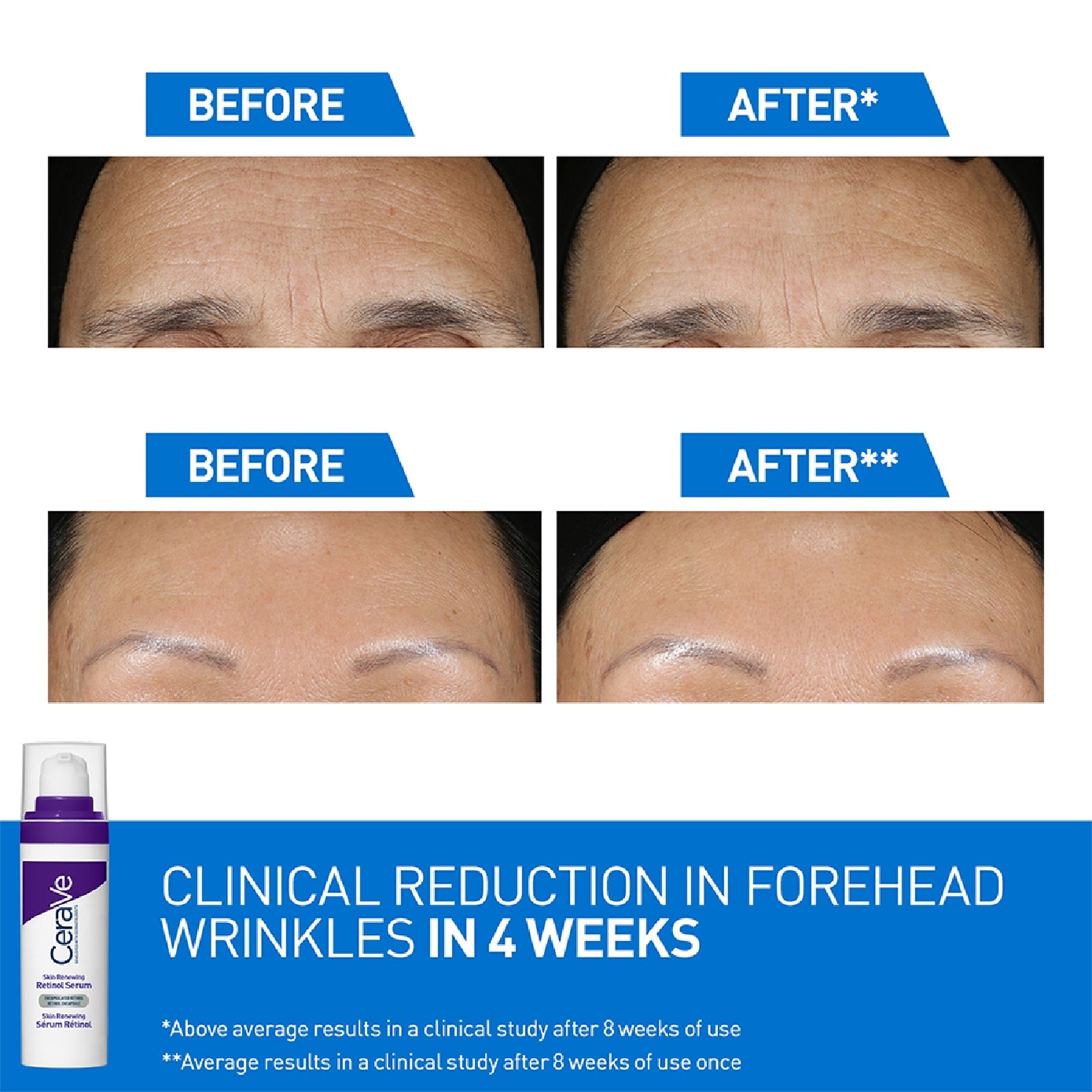 Skin Renewing Retinol Serum 30ml image