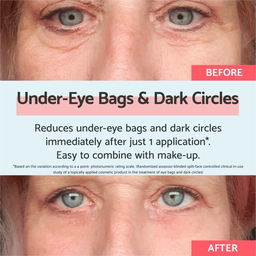 Eye Bags & Dark Circles 8ml