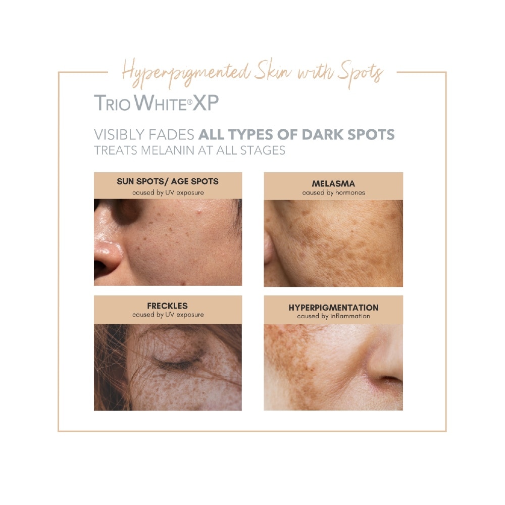 Anti-Dark Spots & Sun Defense Kit 1s
