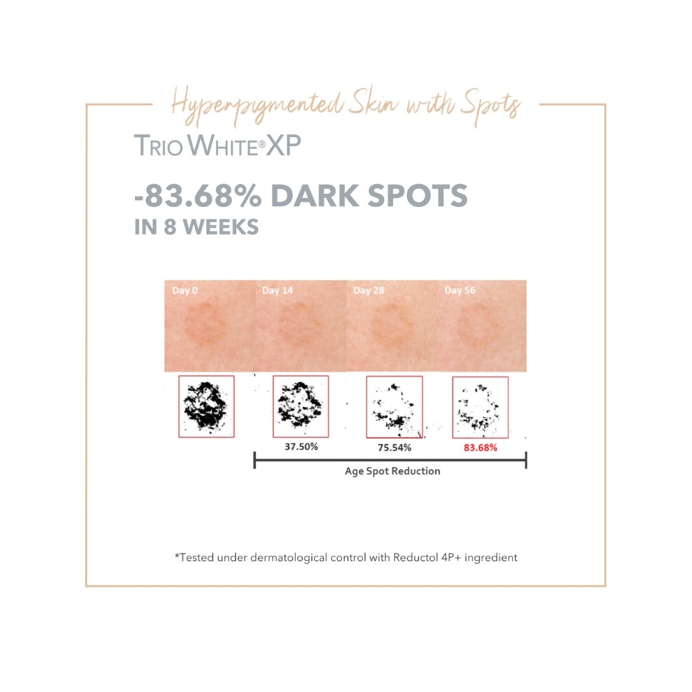 Anti-Dark Spots & Sun Defense Kit 1s