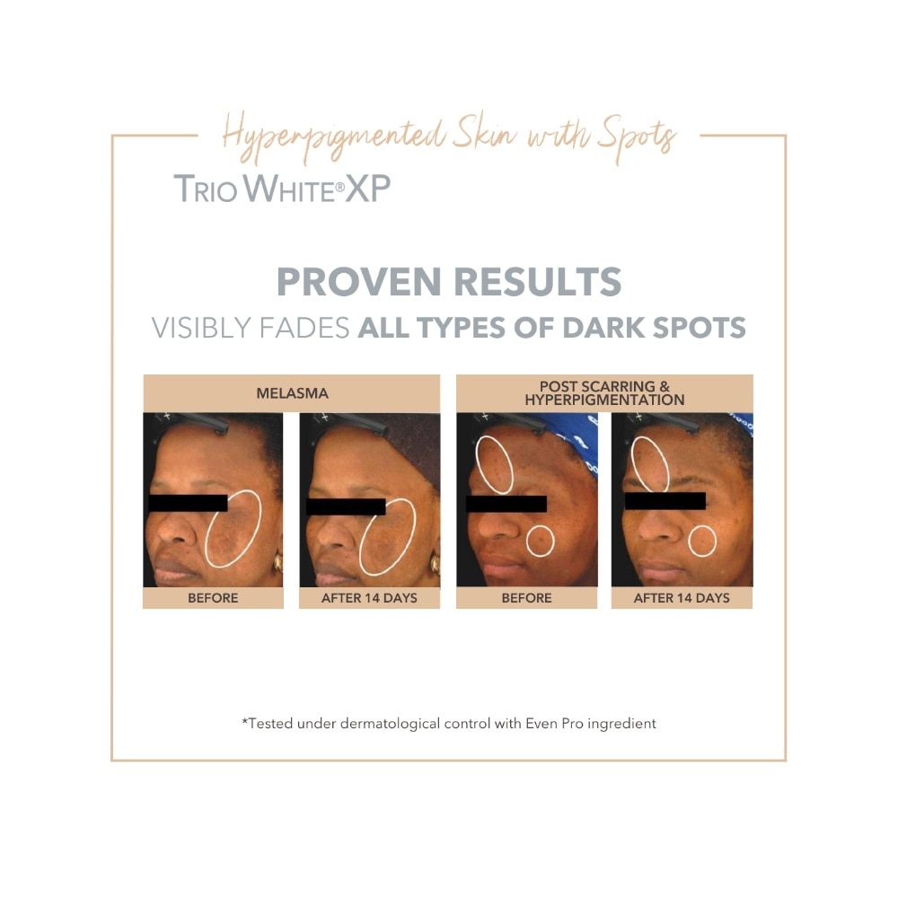 Anti-Dark Spots & Sun Defense Kit 1s