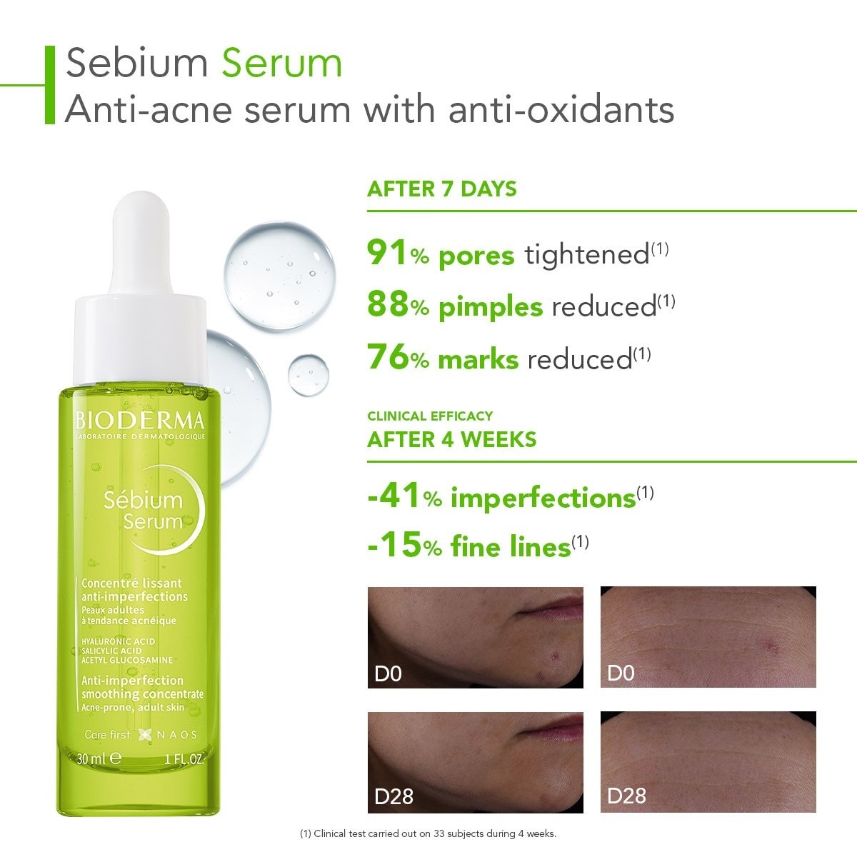 Sebium Serum (Anti Acne Serum, For Oily To Acne Prone Skin) 30ml