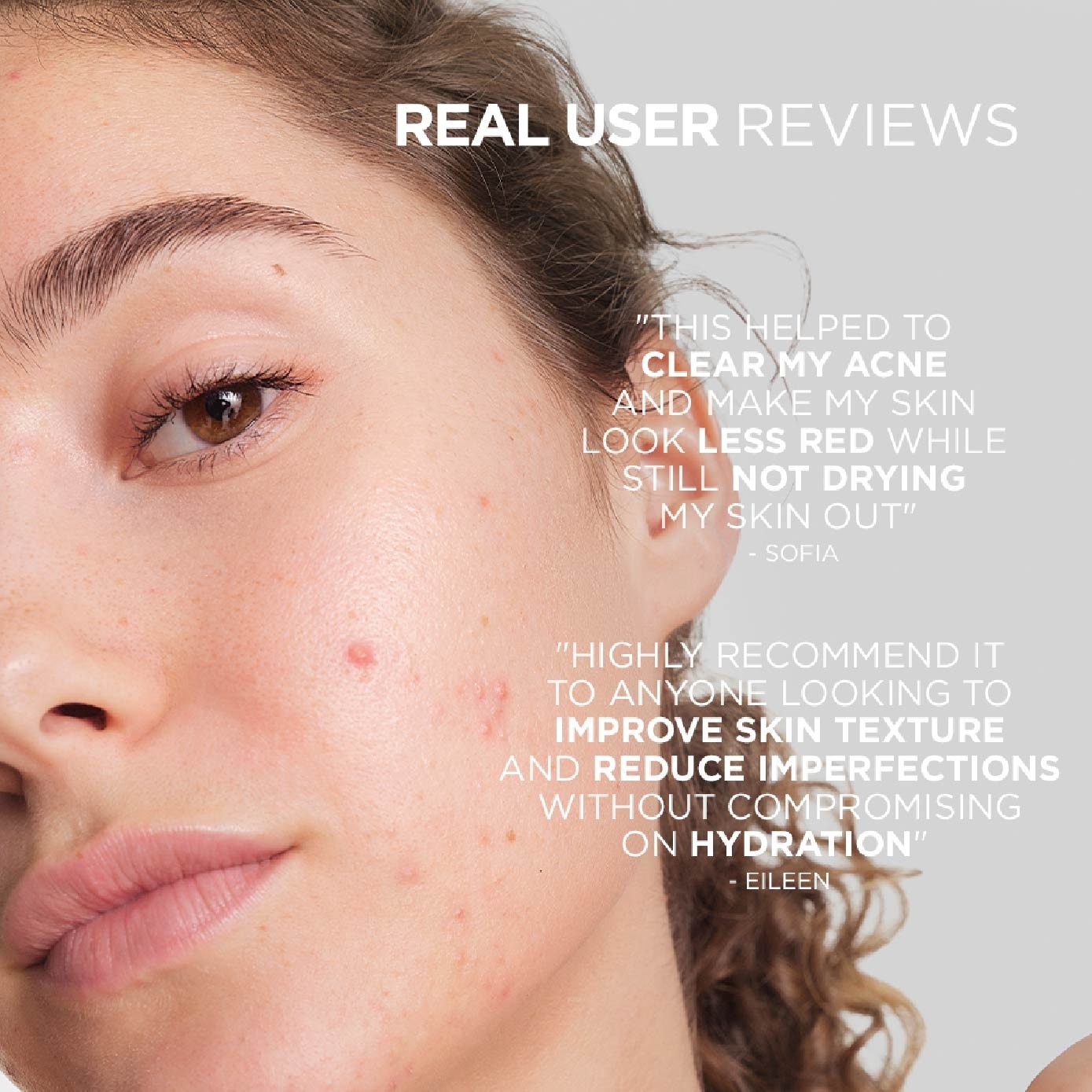 Sebium Serum (Anti Acne Serum, For Oily To Acne Prone Skin) 30ml image