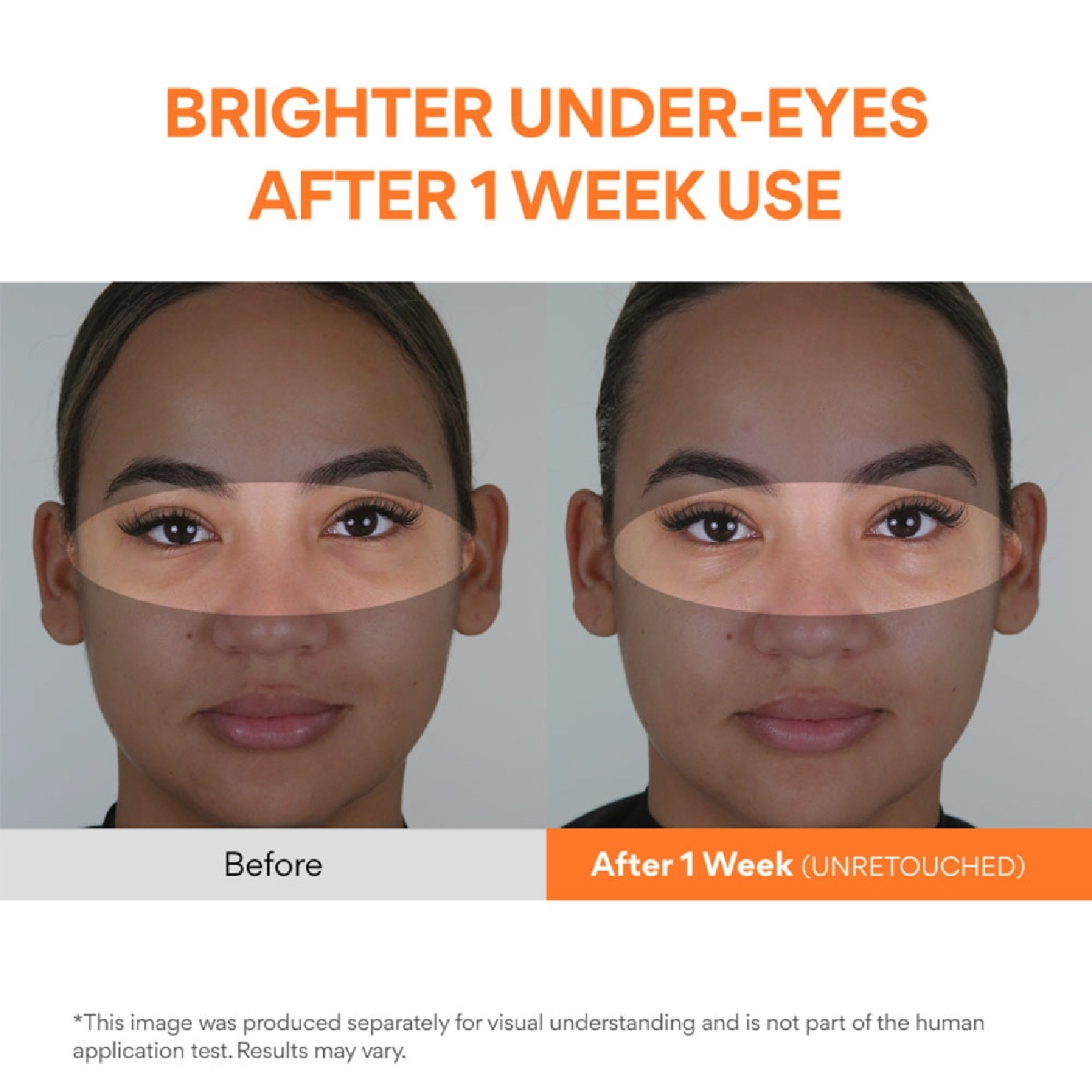 Vitamin C Niacinamide Brightening Eye Serum 10ml
