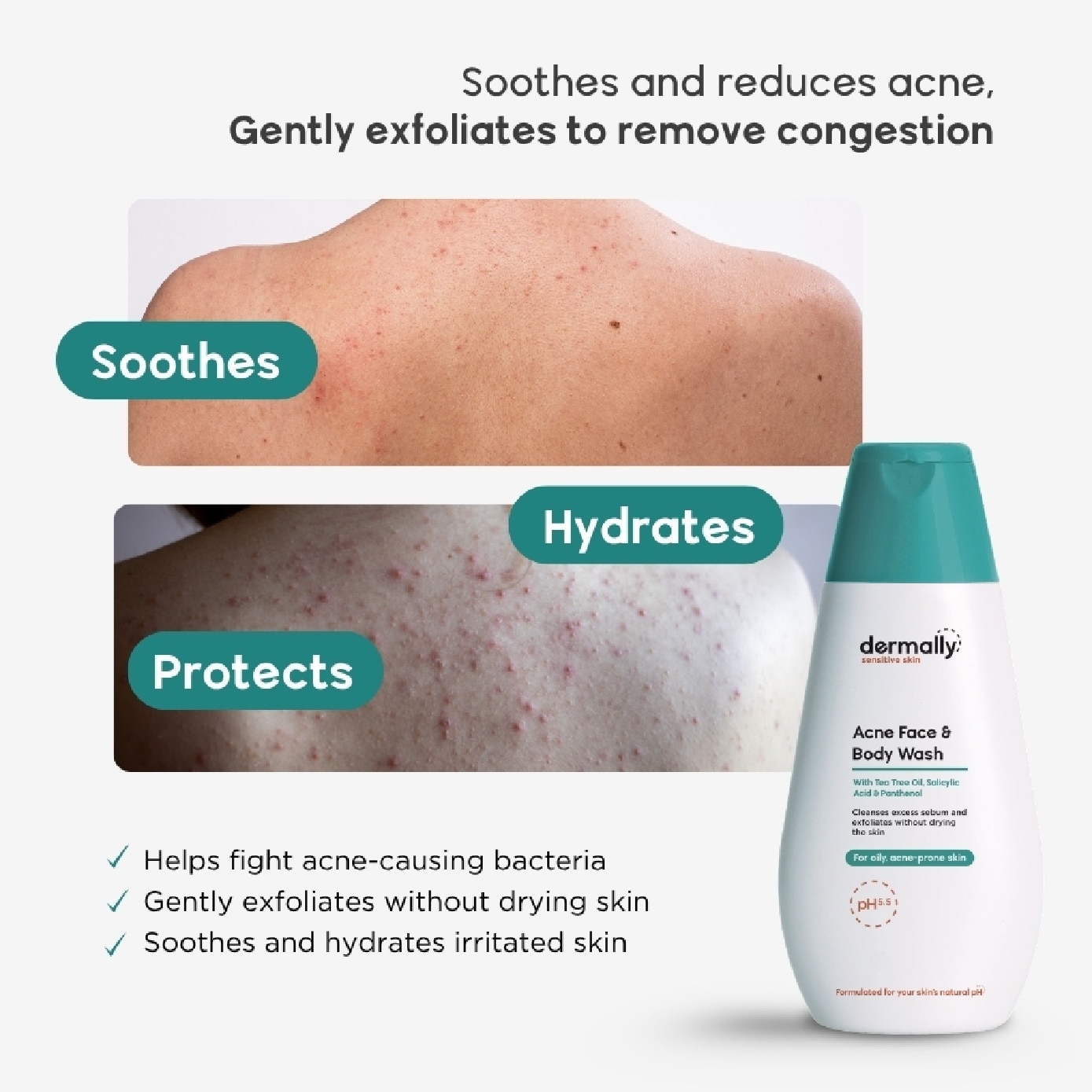 Sensitive Skin Acne Face & Body Wash 200ml