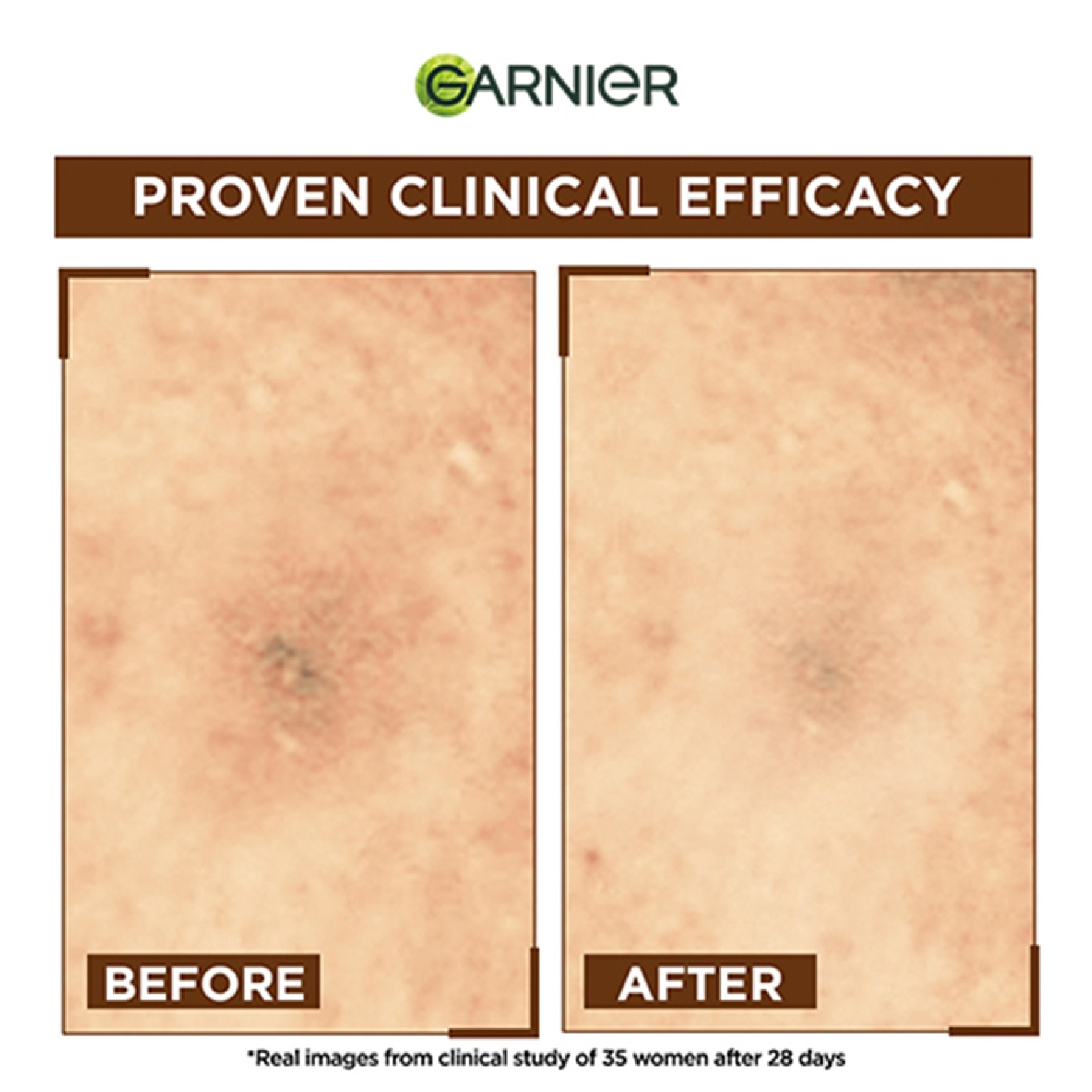 Bright Complete Overnight Serum 15ml