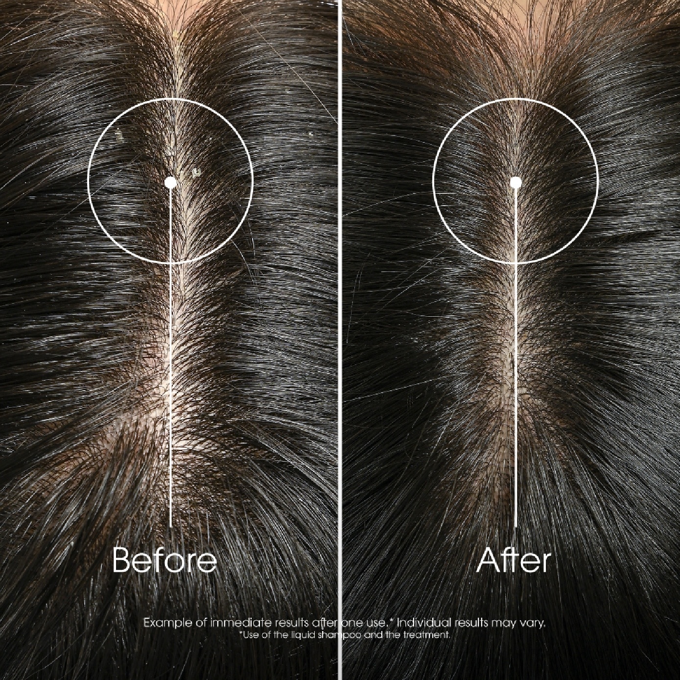 Galangal Anti-Dandruff Rebalancing Shampoo 400ml