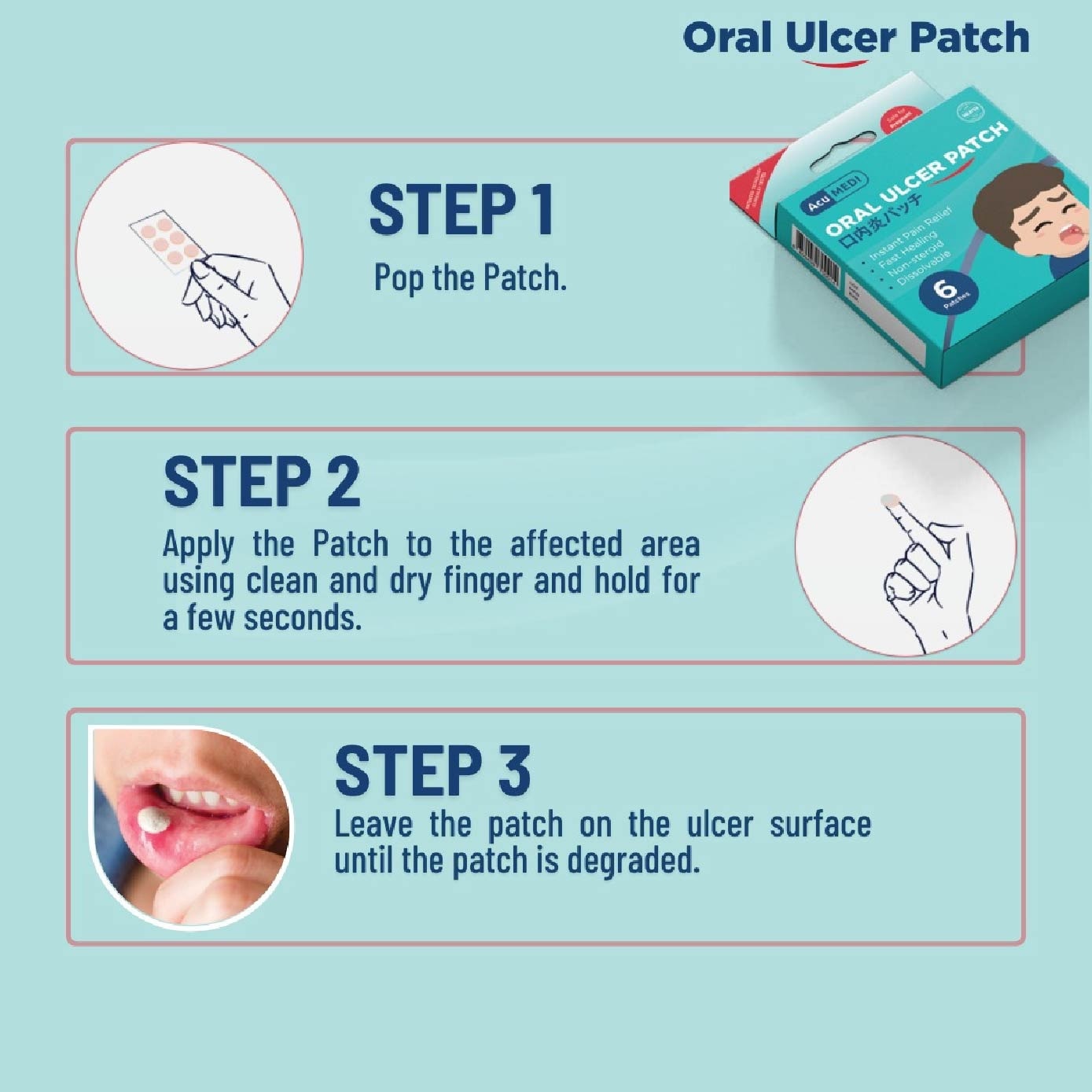 Oral Ulcer Patch (Safe For Pregnant Women & Children) 6s