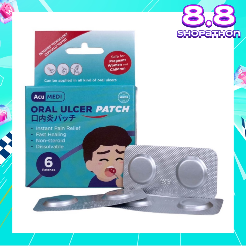 Oral Ulcer Patch (Safe For Pregnant Women & Children) 6s