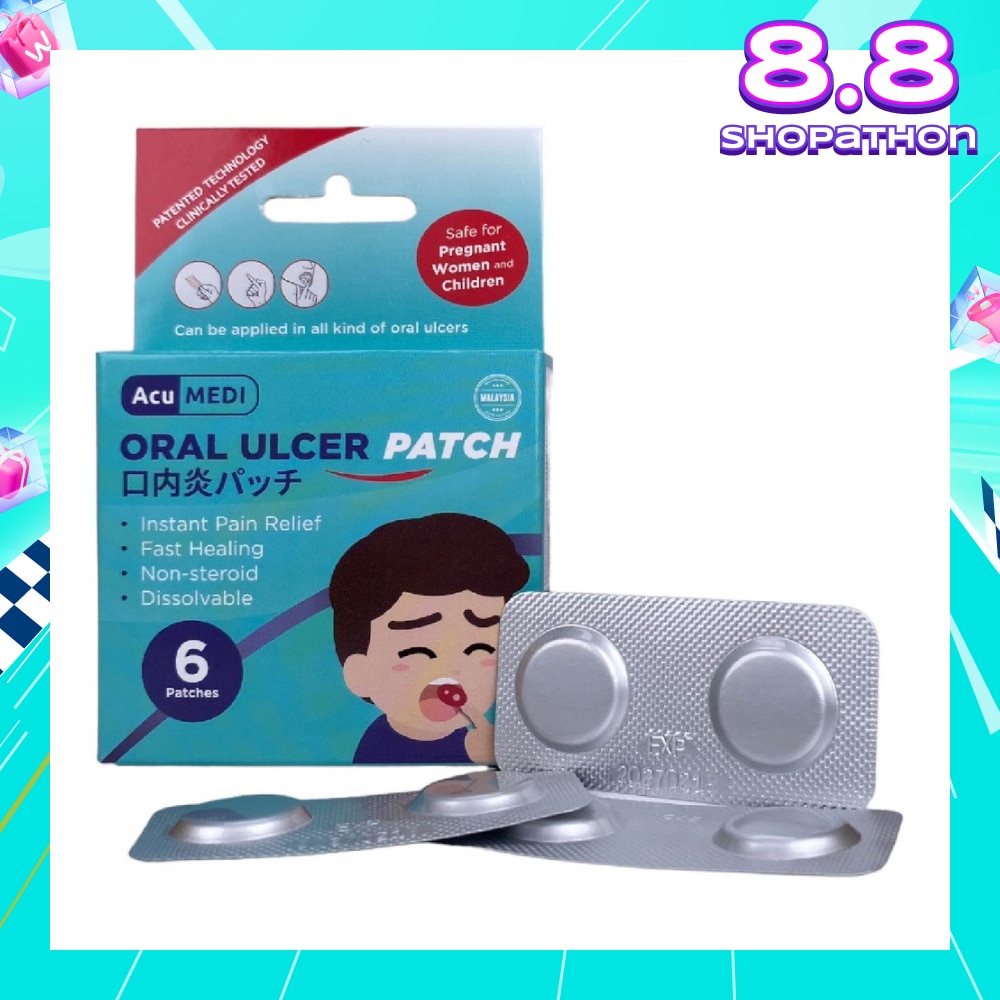 Oral Ulcer Patch (Safe For Pregnant Women & Children) 6s