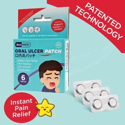 ACUMEDI Oral Ulcer Patch (Safe For Pregnant Women & Children) 6s
