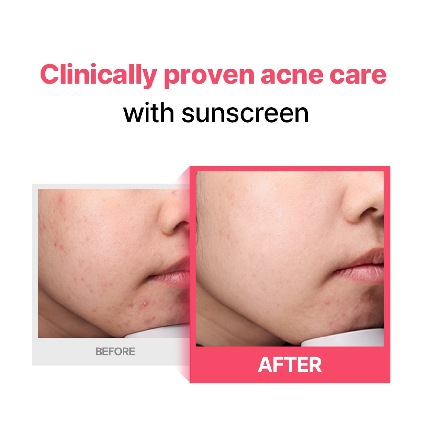 Non-Nano Hyper Shield Sunscreen SPF 50+ PA++++ 50ml image