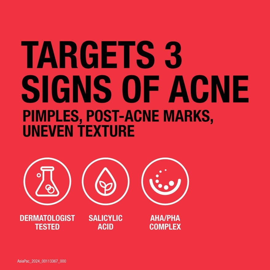 Advanced Acne Serum (Targets Acne & Leaves Skin Hydrated) 30ml