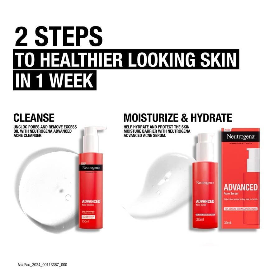 Advanced Acne Serum (Targets Acne & Leaves Skin Hydrated) 30ml