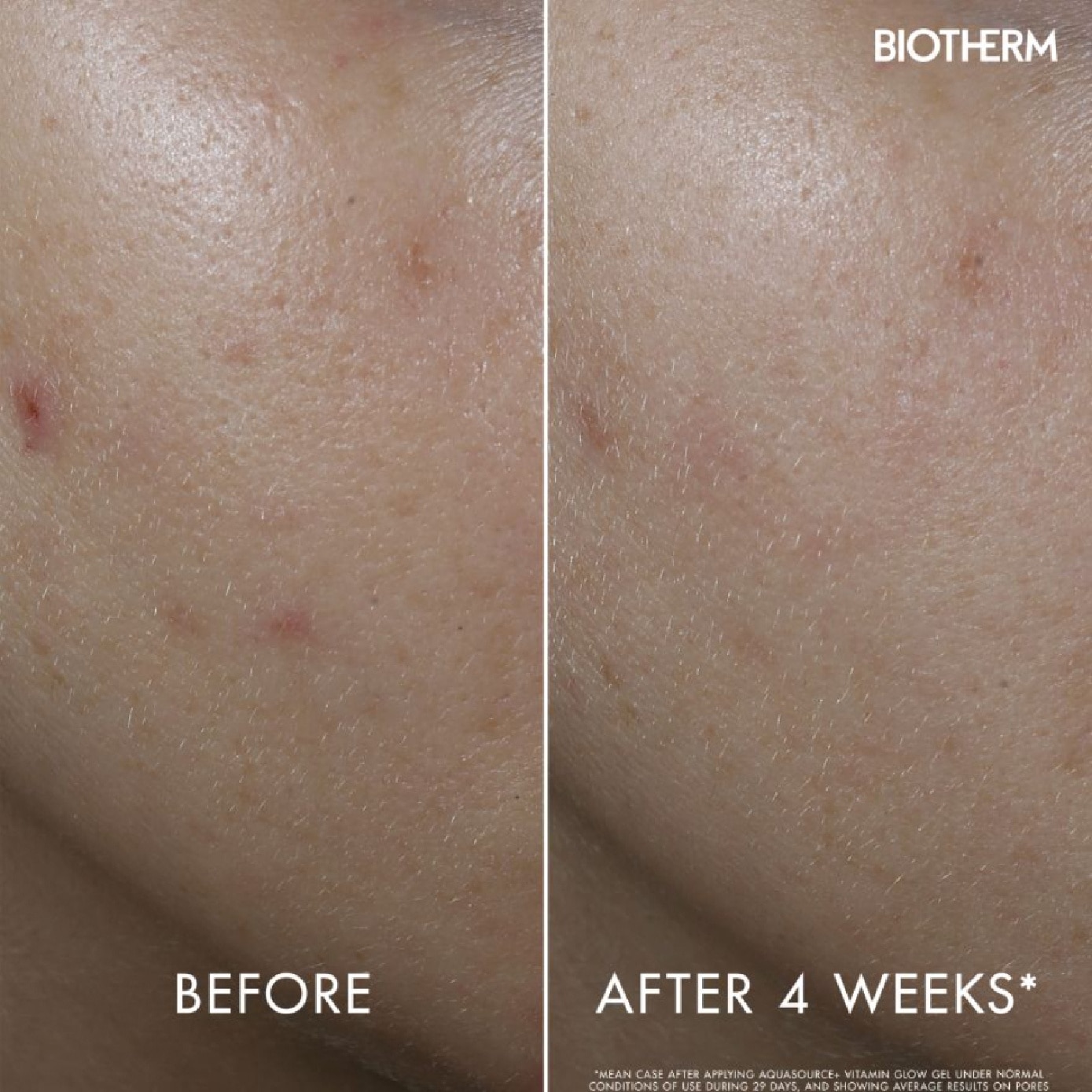 Aquasource+ Vitamin Glow Gel 30ml image