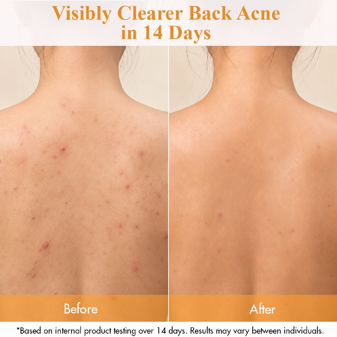 Clarifying Active Derma Body Wash 500ml image