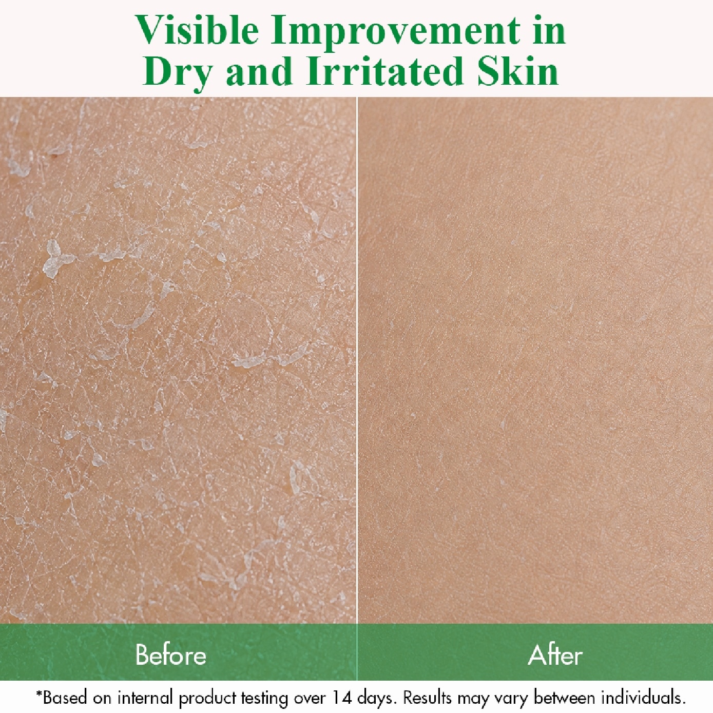 Sensitive Relief Active Derma Body Wash 500ml image