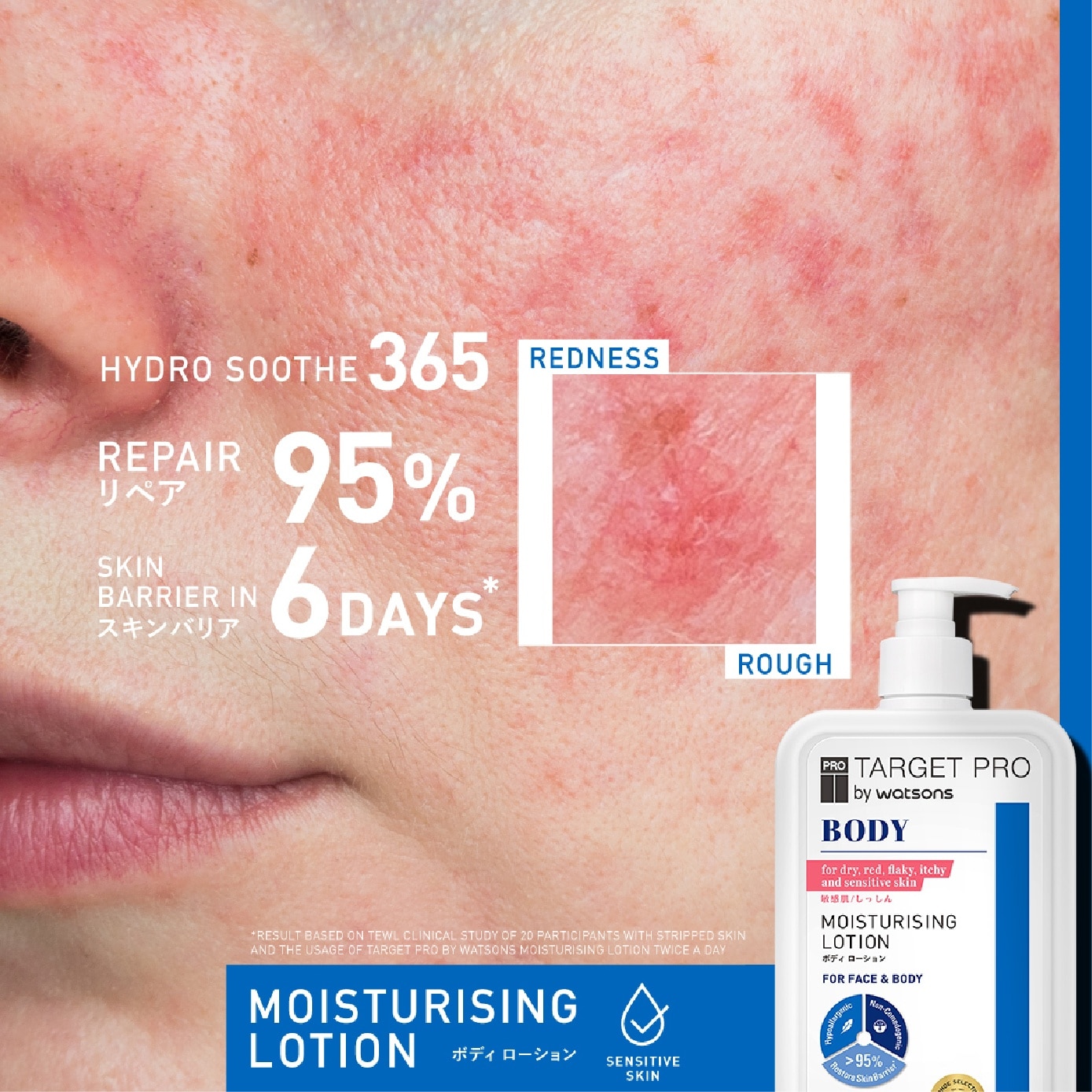 Moisturising Face & Body Lotion (Fragrance-Free & for Dry, Red, Flaky, Itchy and Sensitive Skin) 500ml