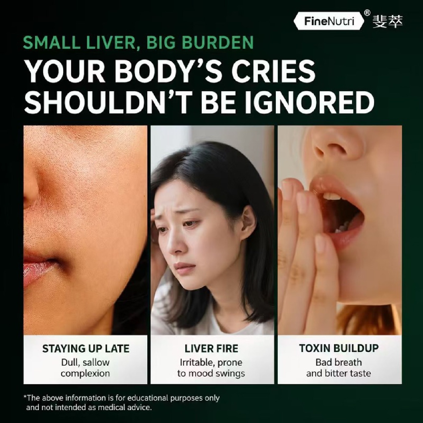 Female Liver Detox Support Capsule 60s image