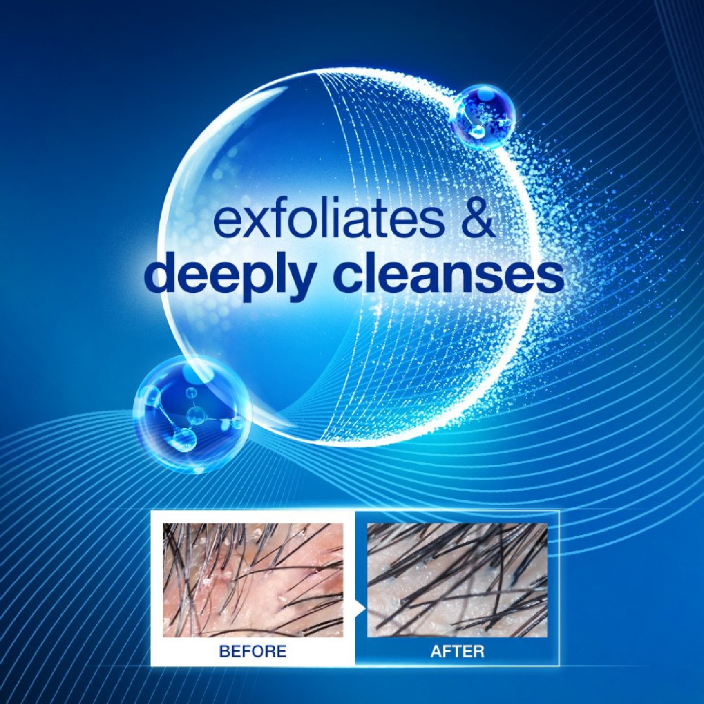 ScalpTECH Dermo Restoring Exfoliating Hair Scrub 160g