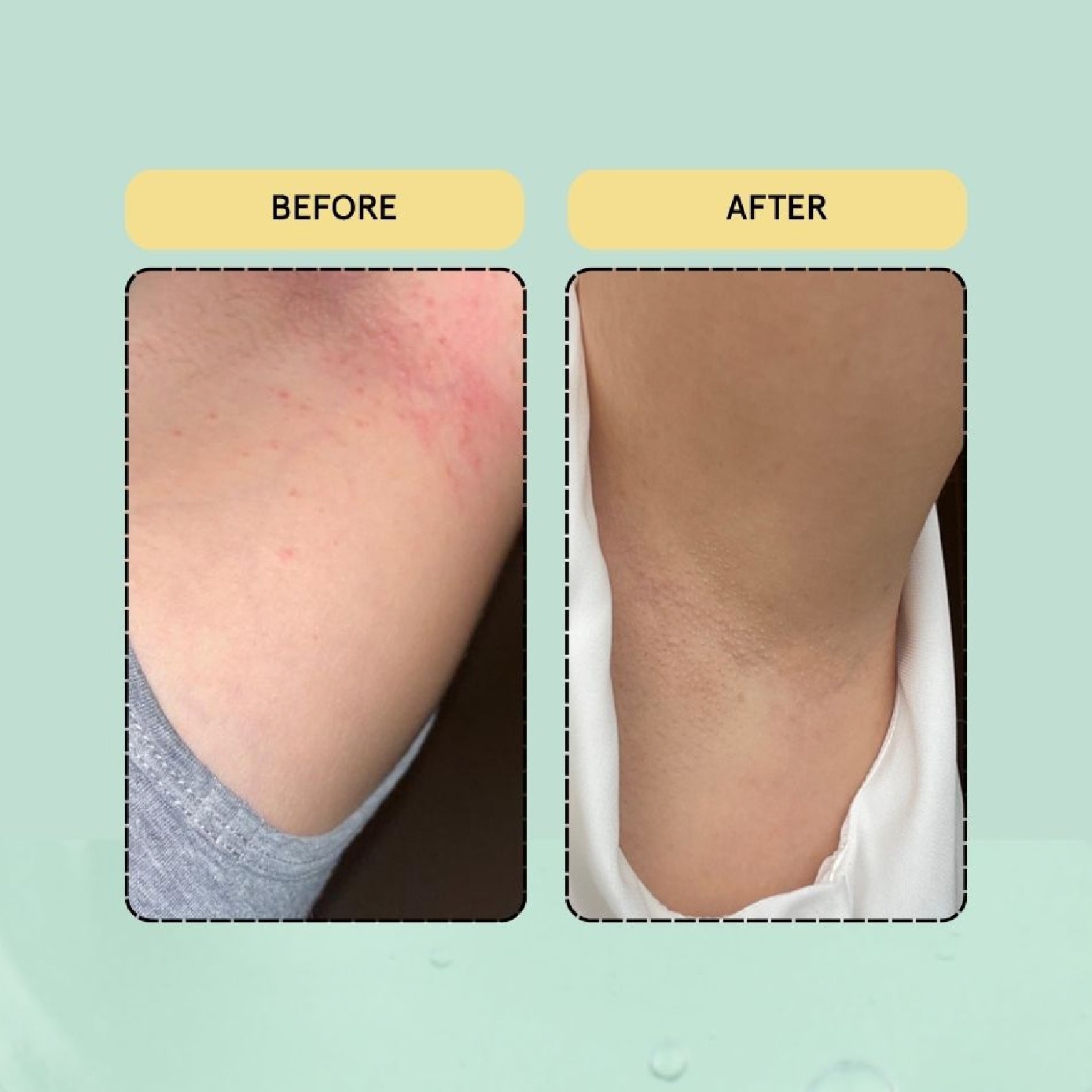 Ultra Brightening Vitamin Deodorant Spray Fresh Mint & Pear 100g image