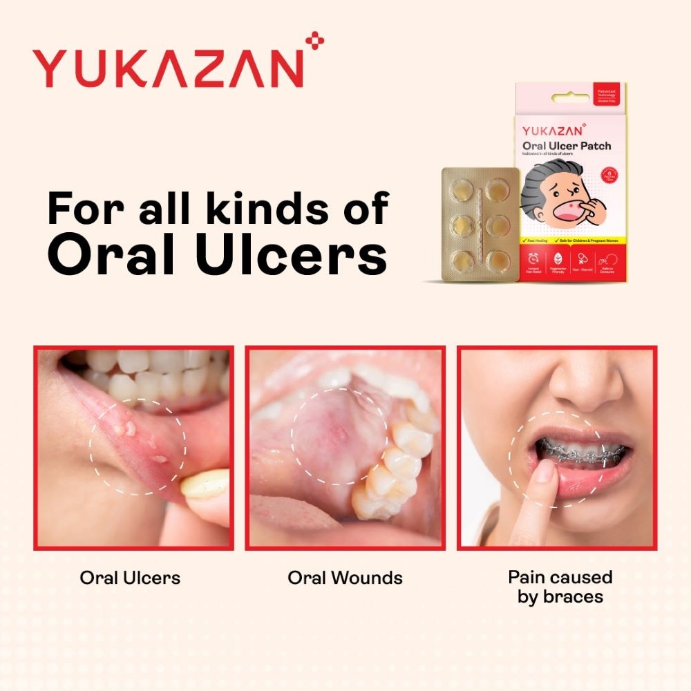 Oral Ulcer Patch (Fast Healing, Safe For Children & Pregnant Women) 6s