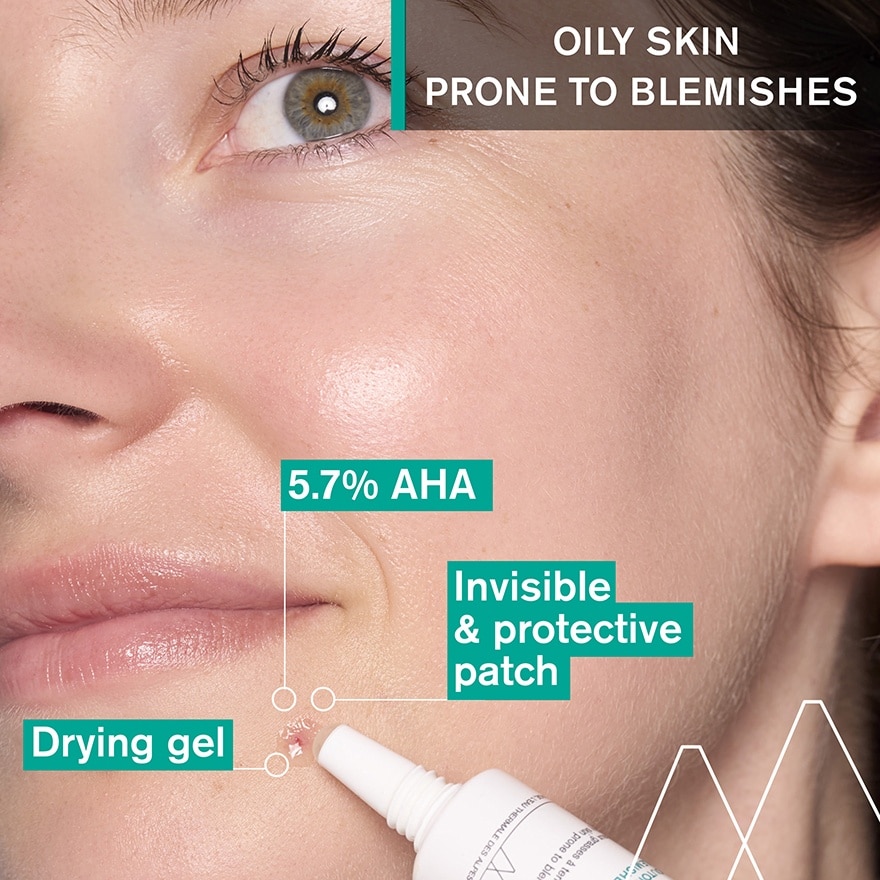 Hyseac SOS Drying Gel (For Oily Skin Prone To Blemishes) 15ml