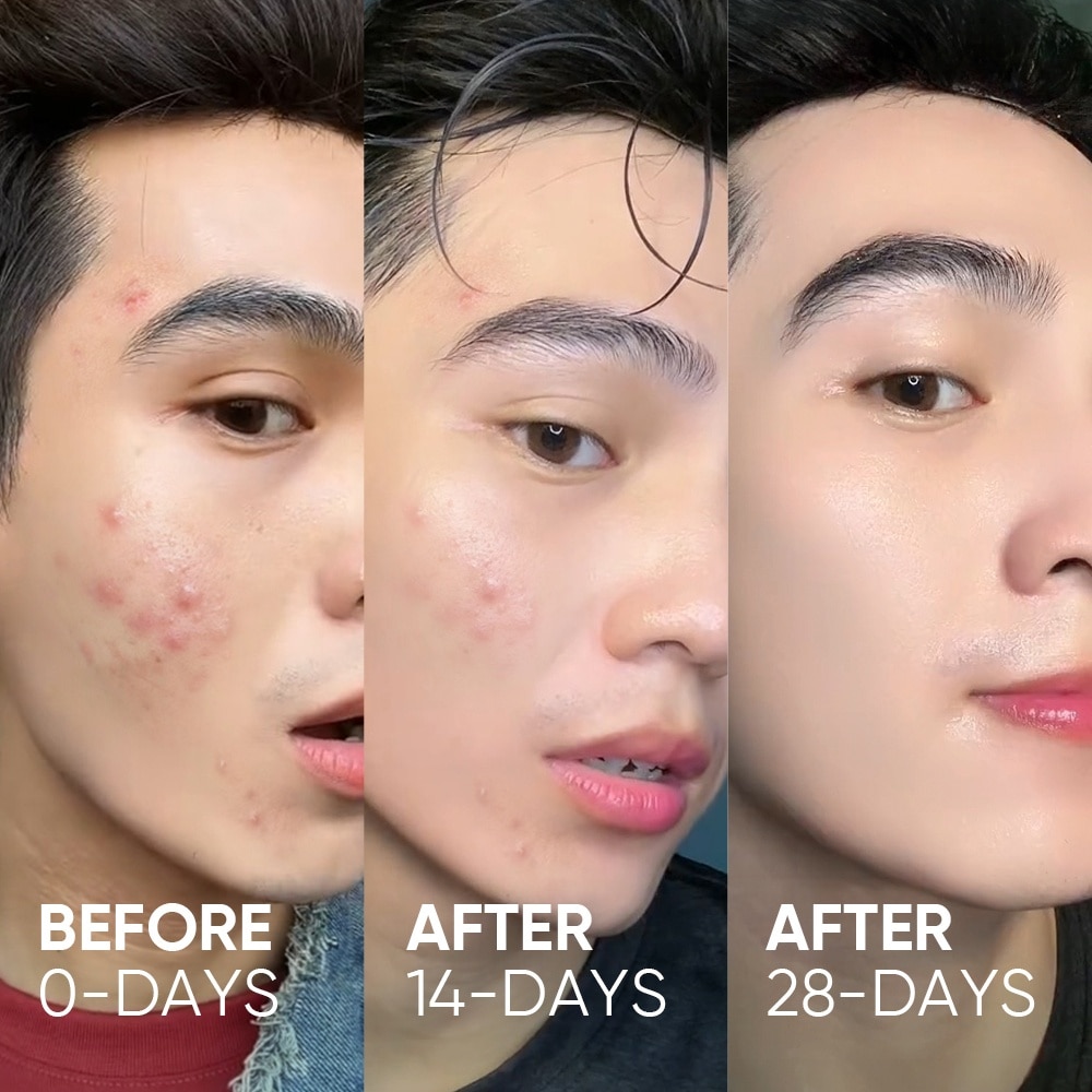 Panthenol Gentle Gel Cleanser (To Removes Dirts & Excess Oils & Refresh & Moisture Skin) 120ml