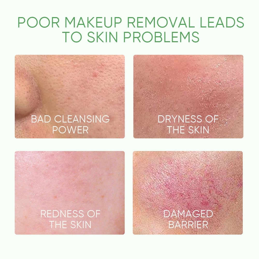 Mugowrt Purifying Micellar Water (To Removes Waterproof Makeup, Clears Excess Oil, Soothes & Calms The Skin) 300ml