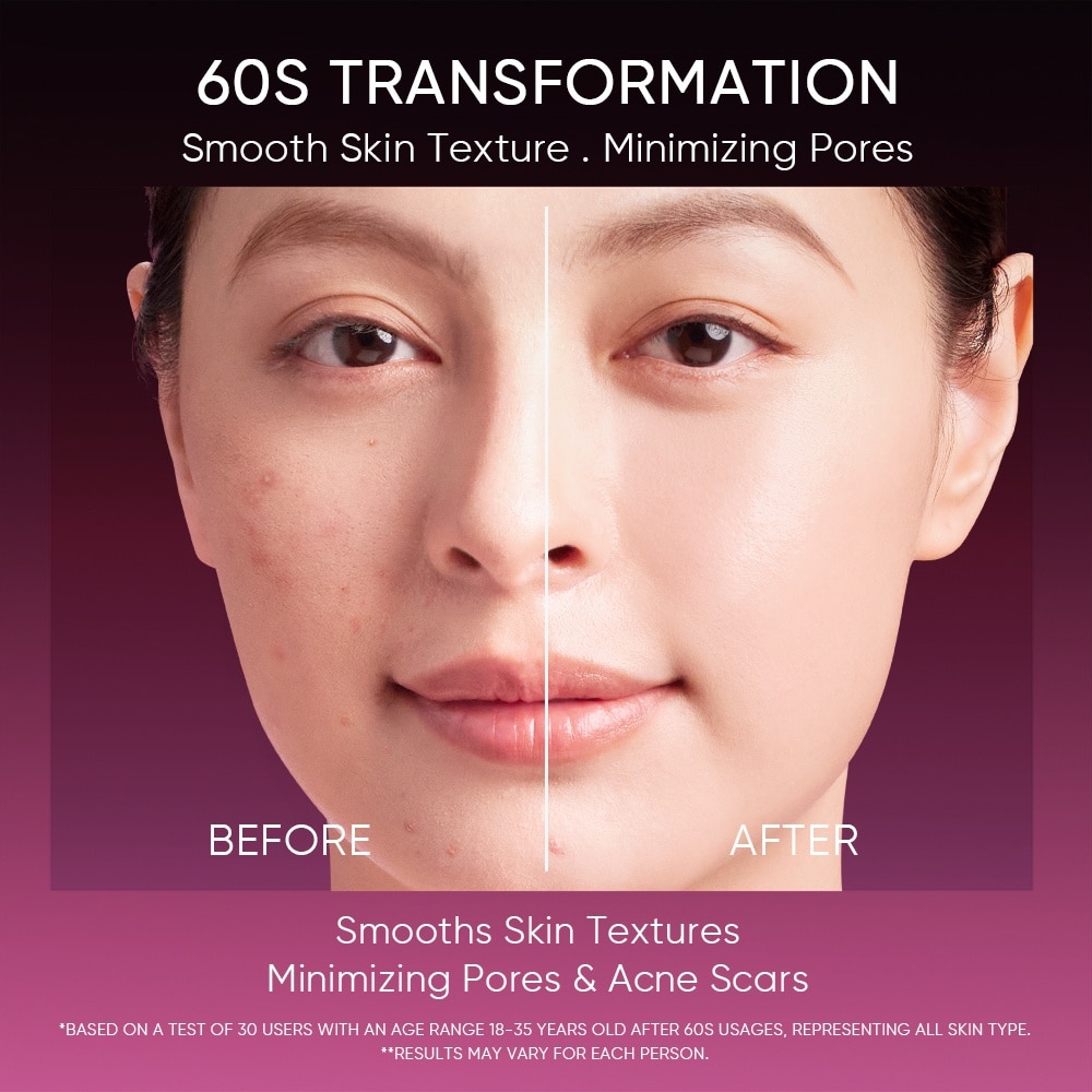 AHA BHA PHA LHA Peeling Solution (To Smooths Skin Texture & Minimize Pore Appearance) 30ml