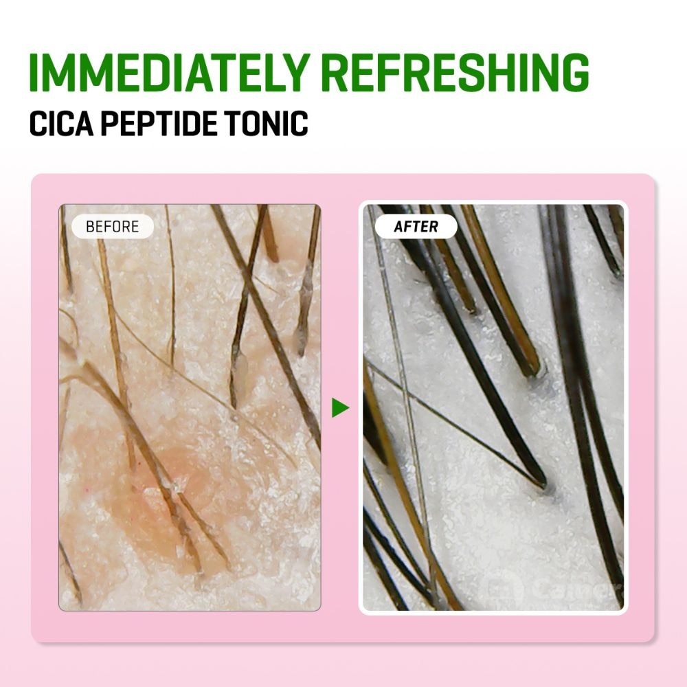 Cica Peptide Anti Hair Loss Derma Scalp Tonic 150ml