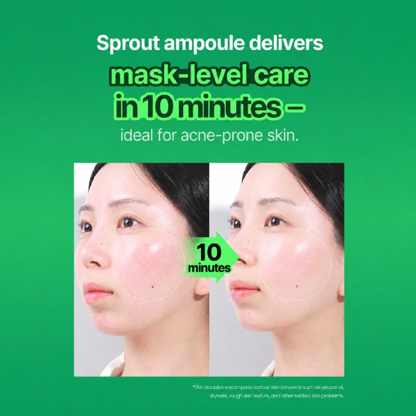 No Problem Spot Softener 150g + Cotton Pad 40s image