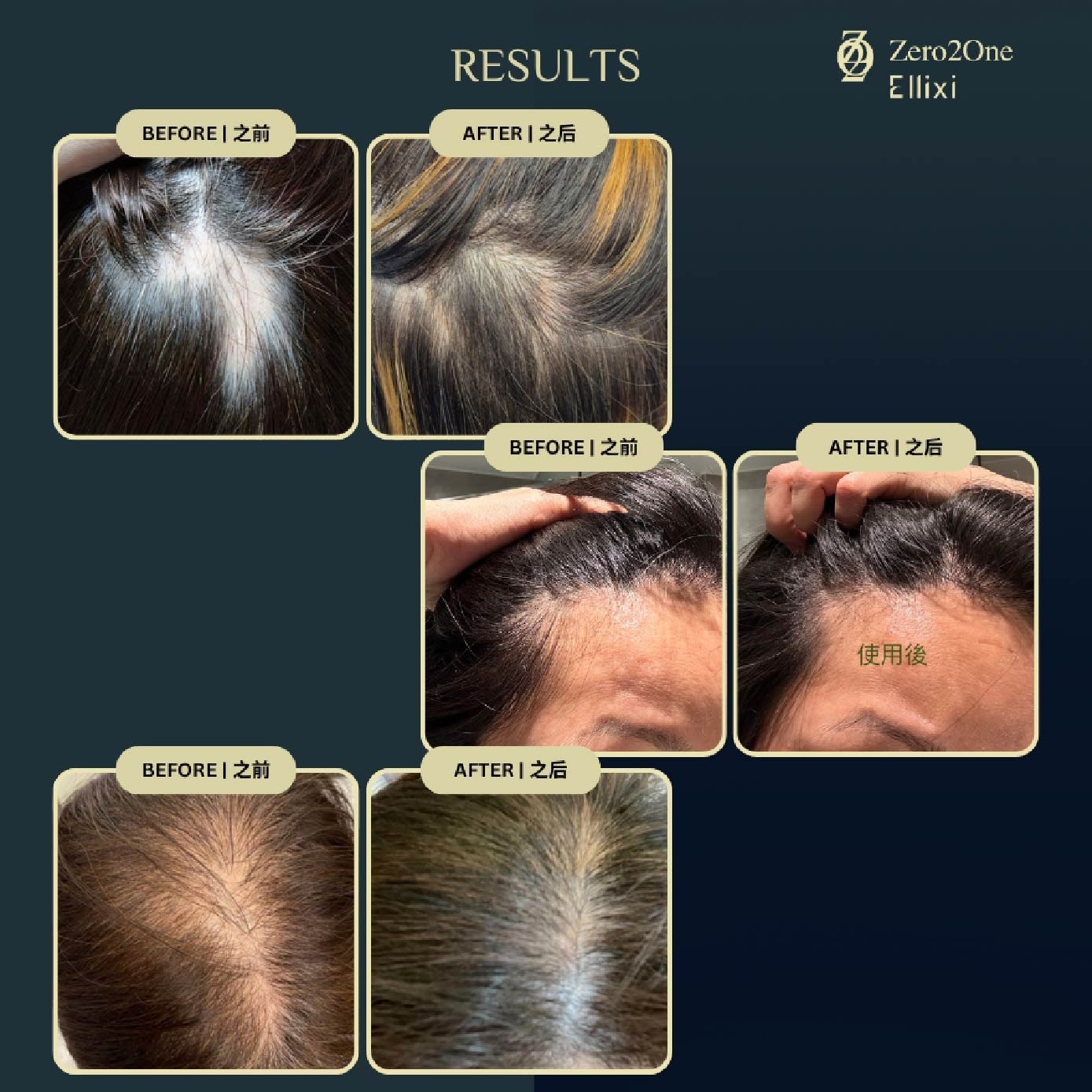 Zero2One Hair Tonic Plus 50ml