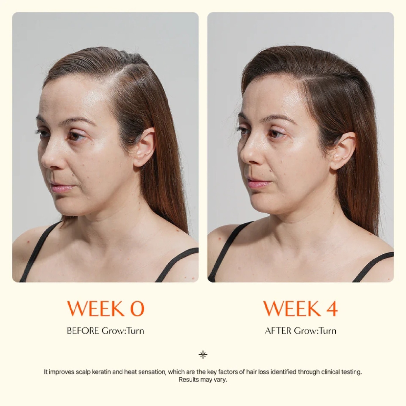 Grow:Turn Anti-Hair Loss Ampoule 100ml