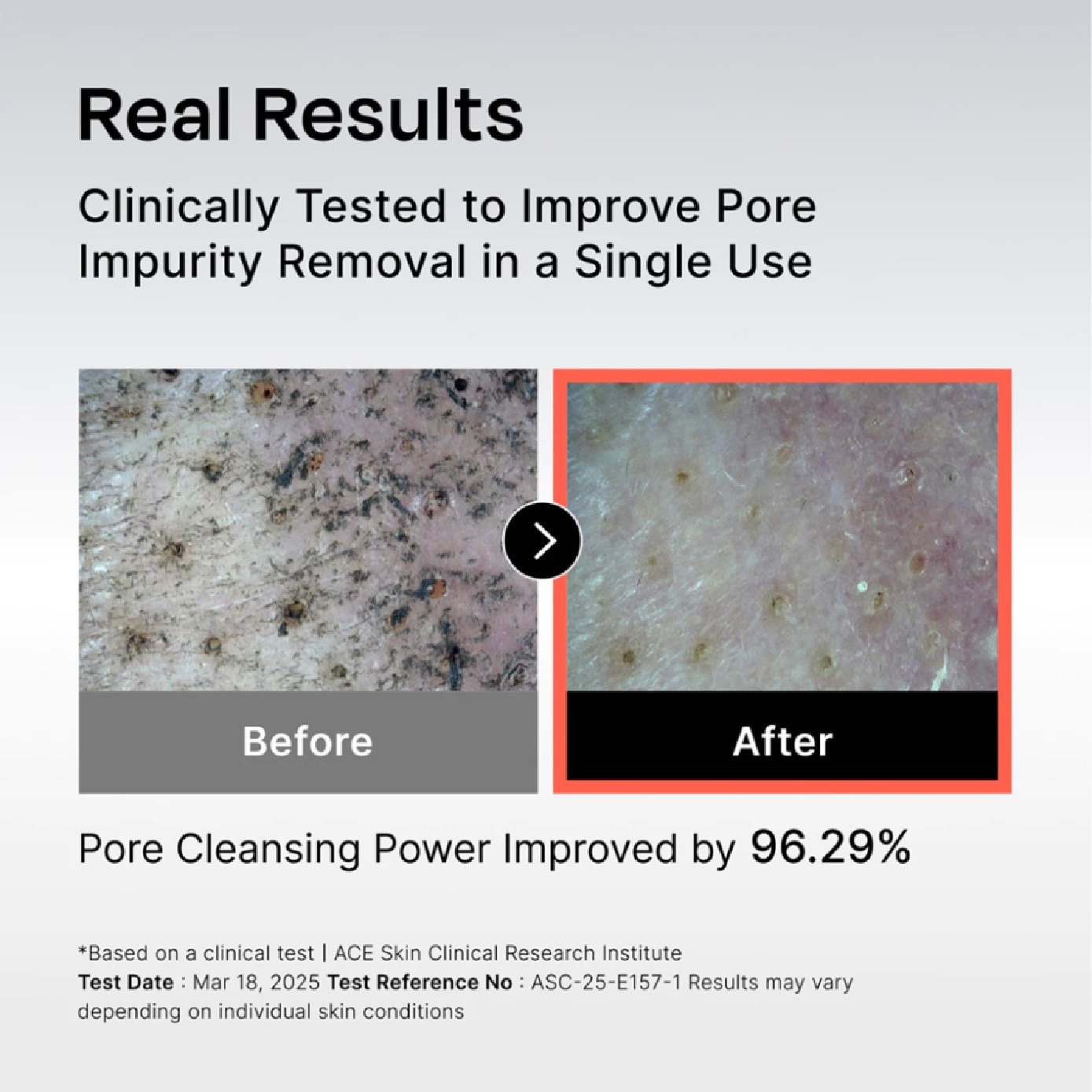 131 Pore Care BHA Cleanser 200ml