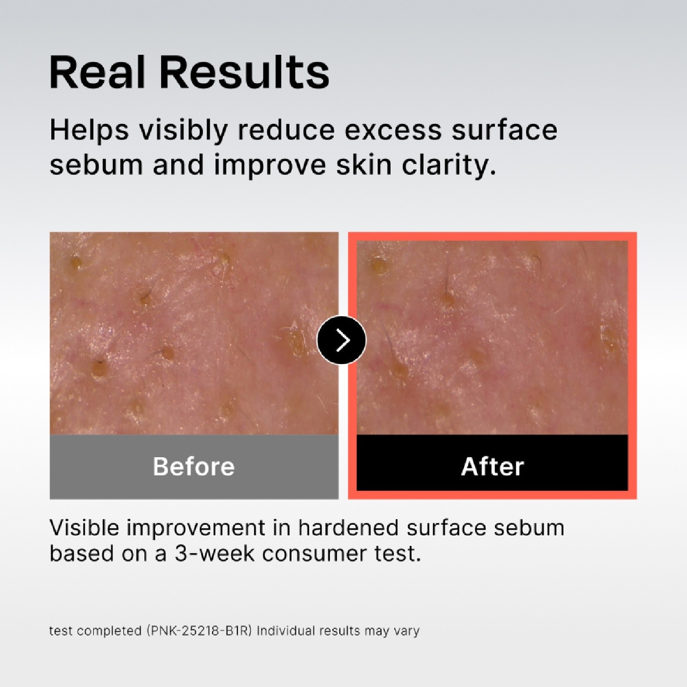 131 Pore Clearing Serum 30ml