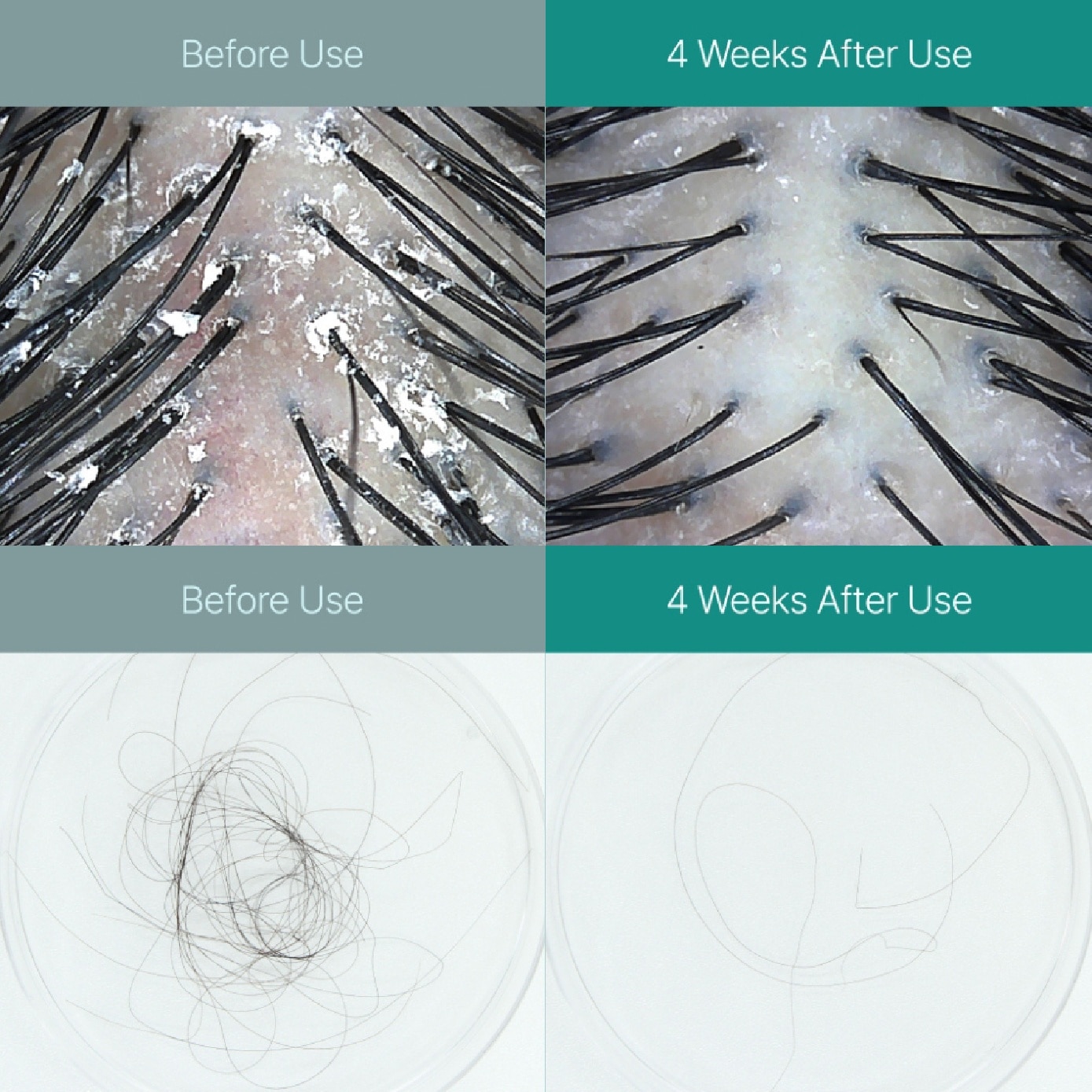 Scalp:Turn Cica PDRN Brush Hair Ampoule 100ml