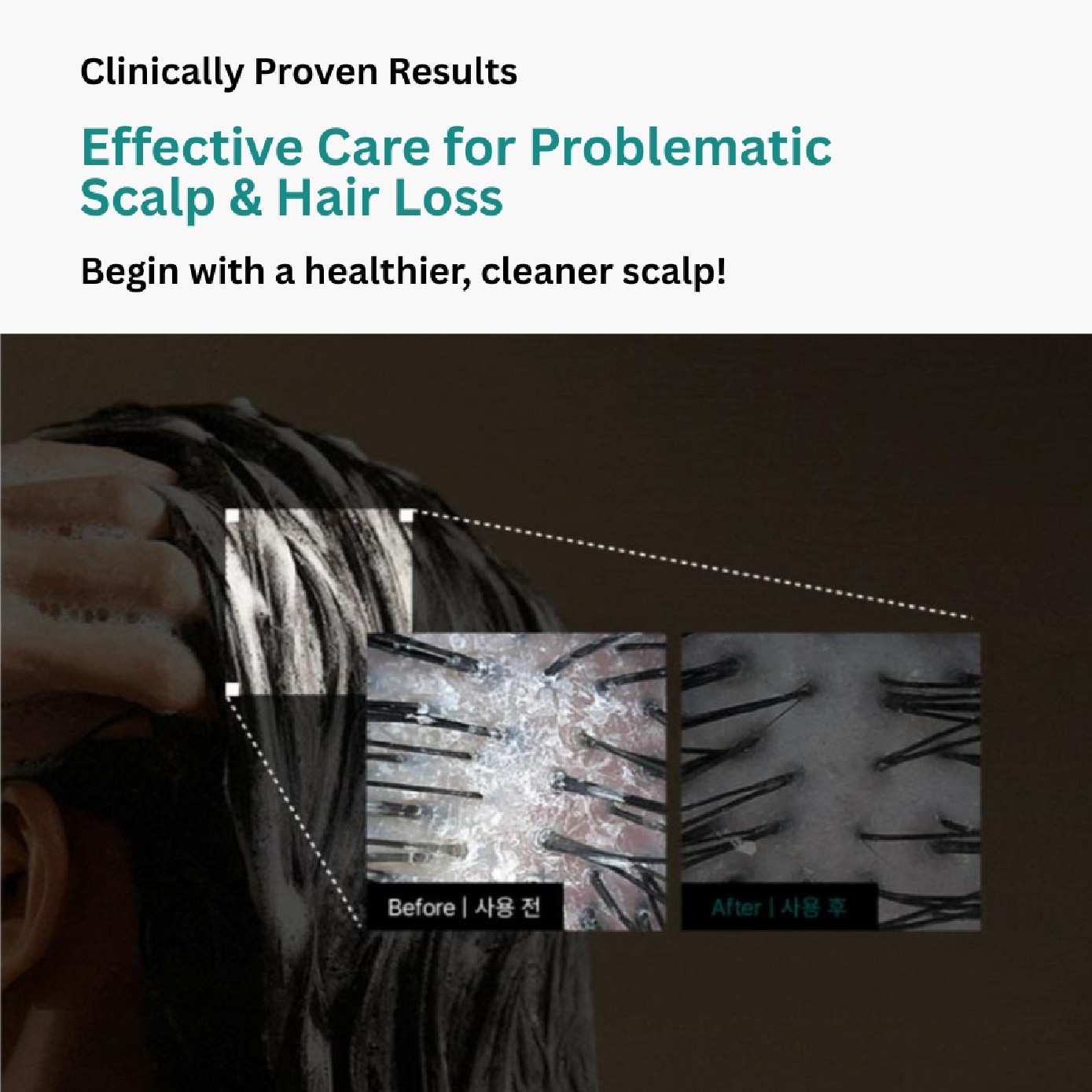 Scalp:Turn Cica PDRN Deep Clean Shampoo 500ml