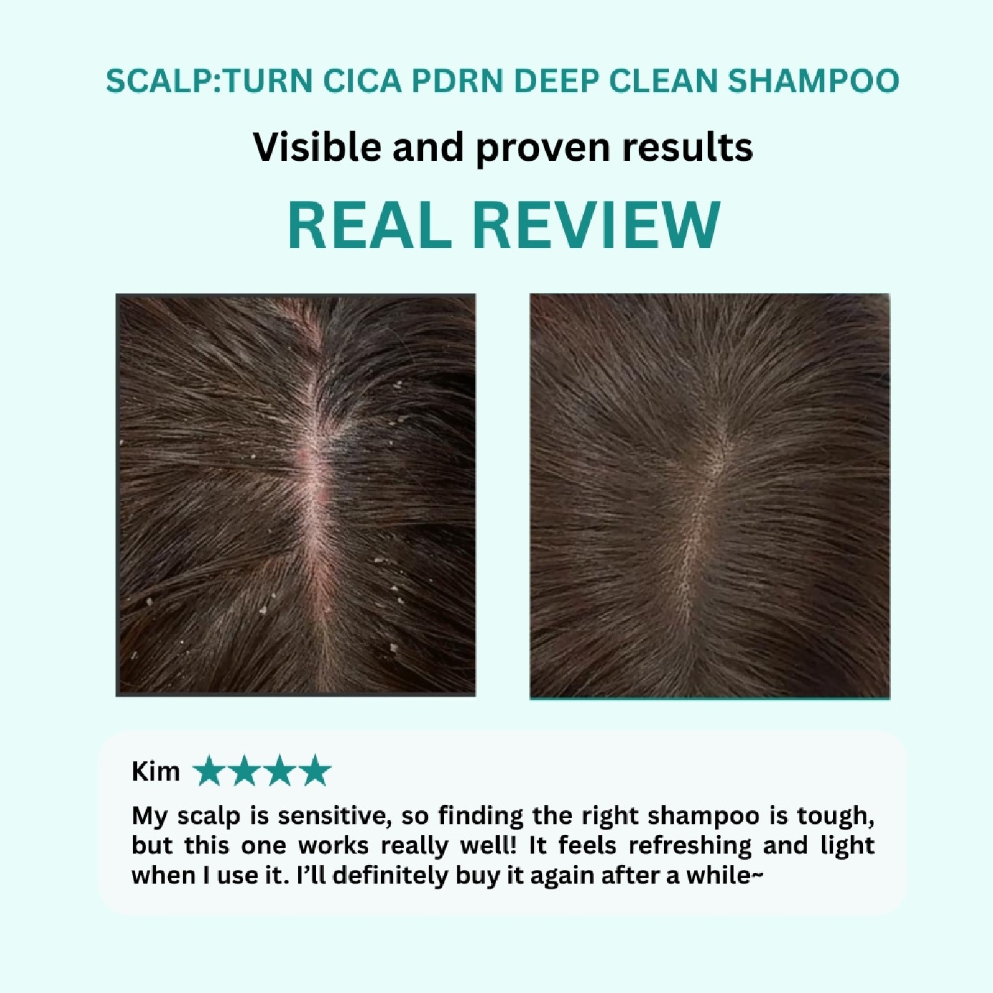 Scalp:Turn Cica PDRN Deep Clean Shampoo 500ml