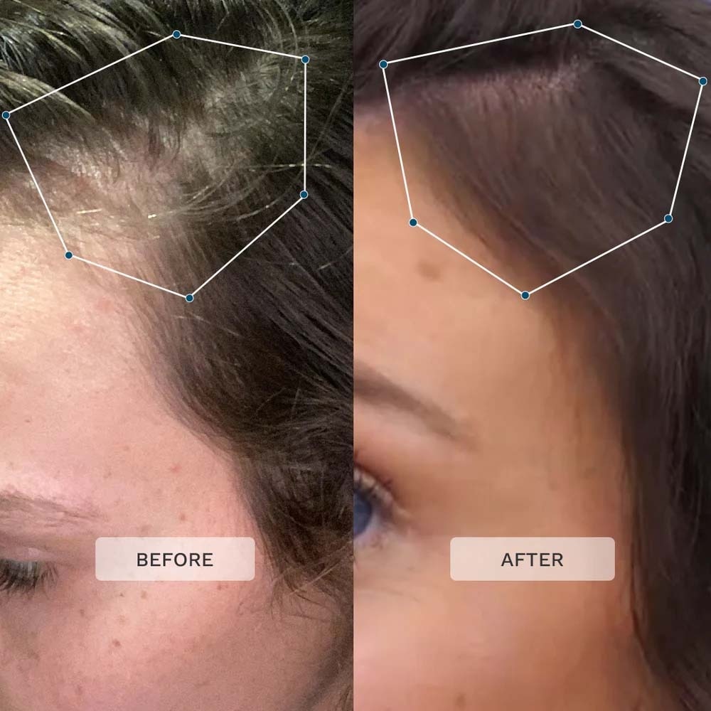 Multi-Active Scalp Serum 60ml